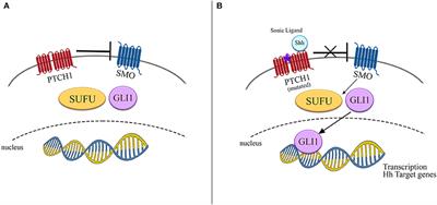 Basal Cell Carcinoma and Hedgehog Pathway Inhibitors: Focus on Immune Response